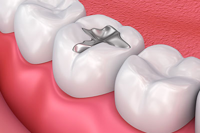 Elizabeth P. Doi, DDS | Pediatric Dentistry, Dental Fillings and Dental Cleanings