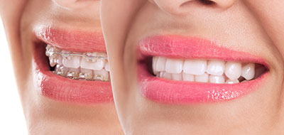 Elizabeth P. Doi, DDS | Dental Cleanings, Crowns and Veneers