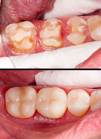 Elizabeth P. Doi, DDS | Dental Fillings, Preventative Program and Crowns