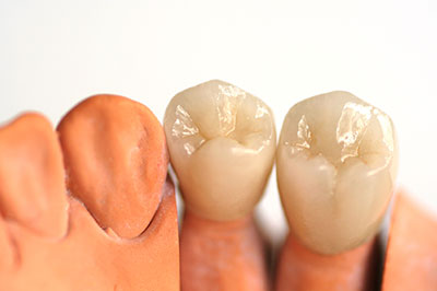 Elizabeth P. Doi, DDS | Dental Bridges, Crowns and Cosmetic Dentistry