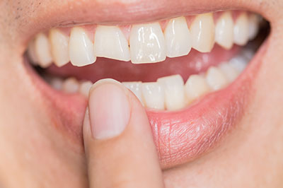 Elizabeth P. Doi, DDS | Oral Exams, Cosmetic Dentistry and Root Canals