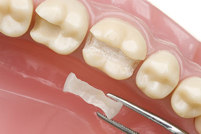 Elizabeth P. Doi, DDS | Root Canals, Cosmetic Dentistry and Night Guards