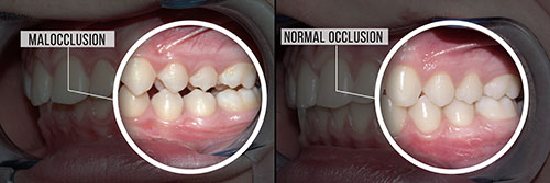 Elizabeth P. Doi, DDS | Cosmetic Dentistry, Pediatric Dentistry and Veneers