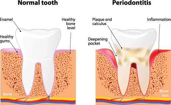 Elizabeth P. Doi, DDS | Cosmetic Dentistry, Teeth Whitening and Dentures