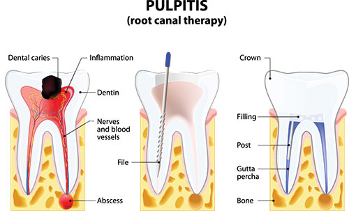 Elizabeth P. Doi, DDS | Oral Exams, Dental Bridges and Night Guards