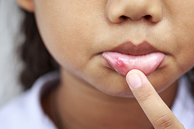 Elizabeth P. Doi, DDS | Preventative Program, Cosmetic Dentistry and Dental Bridges