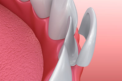 Elizabeth P. Doi, DDS | Dentures, Night Guards and Oral Exams