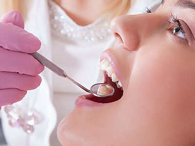 Elizabeth P. Doi, DDS | Dental Fillings, Night Guards and Preventative Program
