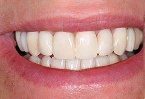 Elizabeth P. Doi, DDS | Dental Fillings, Veneers and Night Guards