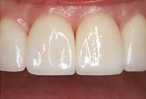 Elizabeth P. Doi, DDS | Crowns, Dental Bridges and Night Guards