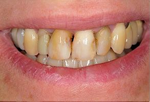 Elizabeth P. Doi, DDS | Dentures, Dental Fillings and Night Guards